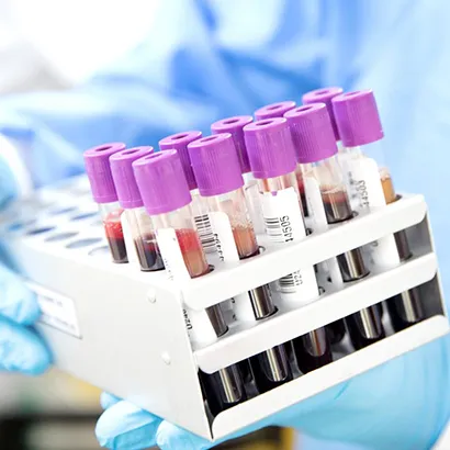 Laboratuvar Hizmetleri